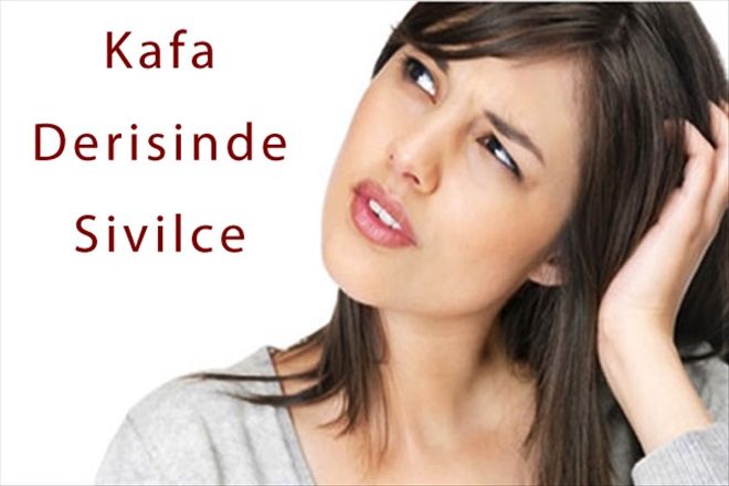 Kafa Derisinde Sivilce Oluşmasının Sebebi