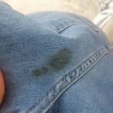 Kot Pantolonlarda Kirli Lekeler: Nasıl Gider?