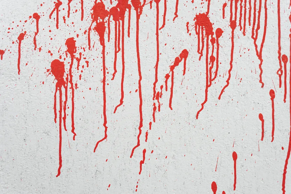 Kırmızı Lekeleri Giderirken Dikkat Edilmesi Gerekenler